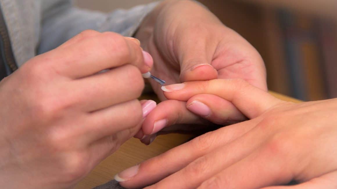 ongle
